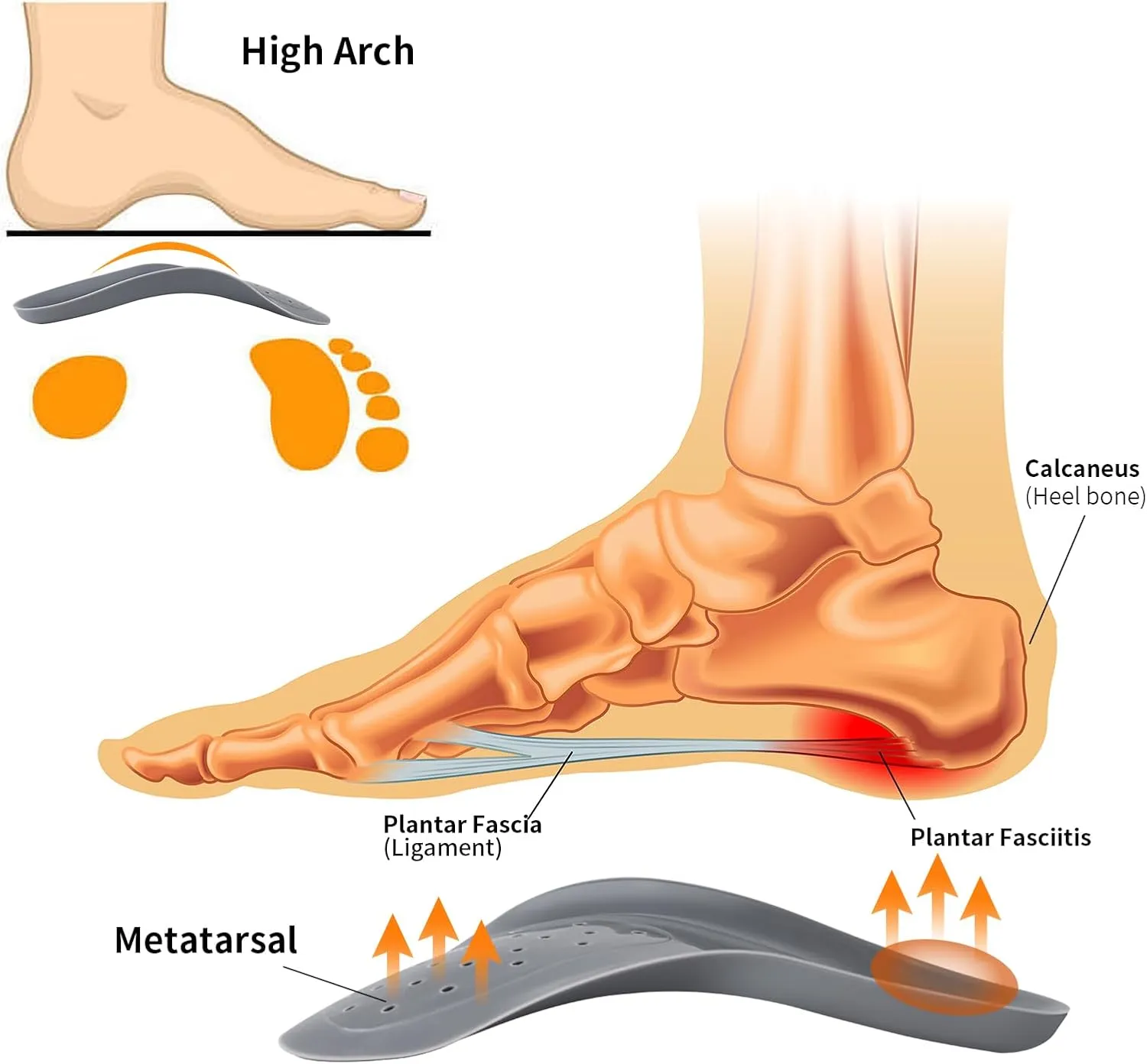 Original 3/4 Arch Support Metatarsal Support Orthotics Over-Pronation Insoles Relieve Plantar Fasciitis, Arch, Heel & Ankle Foot Pain (Gray, Men 9-12/Women 11-14)