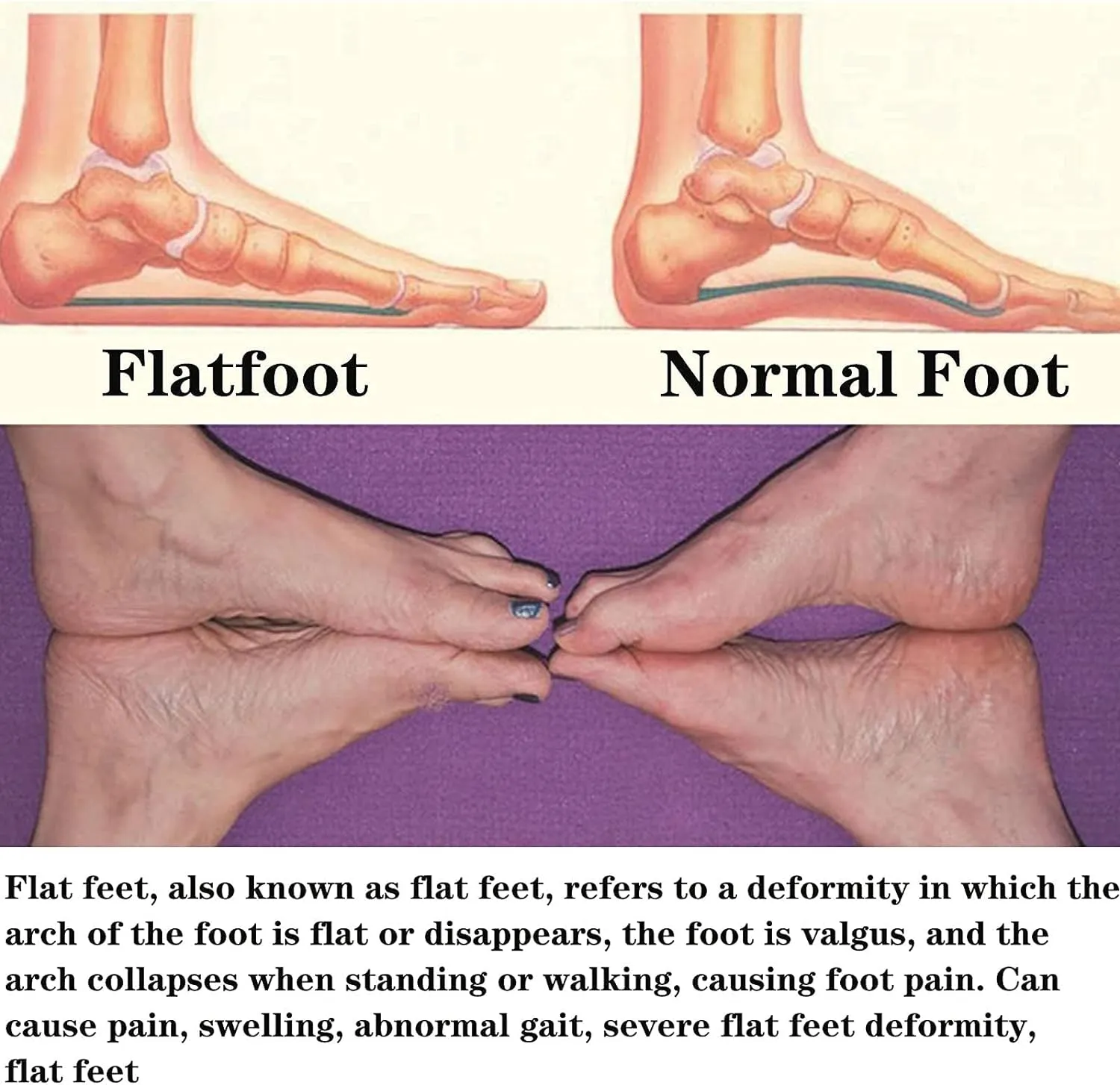 Orthotic Arch Support Shoe Insoles